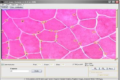 Captura GSA Image Analyser